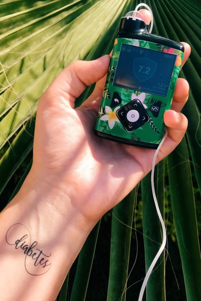 Medtronic_Minimed670G_Reisen