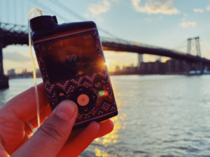 Medtronic MiniMed 670G Review